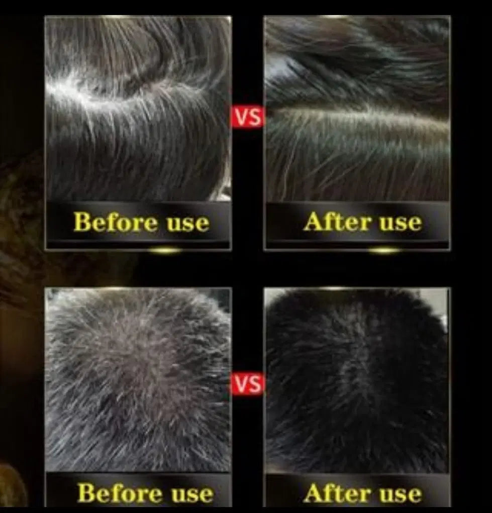 BLOSDREAM 3 in 1 Black Hair Shampoo