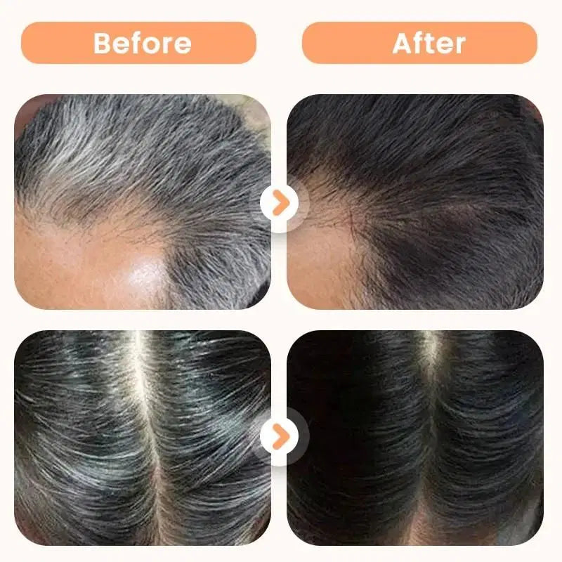 Plant Extract Hair Dye for Gray Hair 200 ml (Pack of 1)